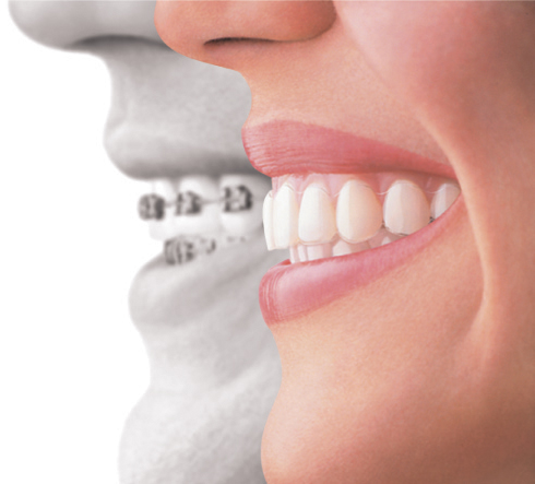 デメリットもあります