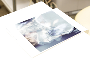 マウスピース矯正の流れ 精密検査