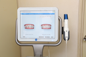 マウスピース矯正の流れ 3D光学スキャナーによる歯型の採取